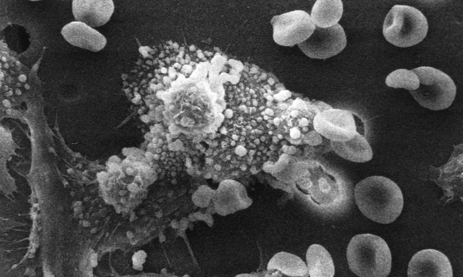 英語脳メルマガ 第号 A Therapy That Retrains The Body S Immune System To Fight Cancer の意味は 英語脳ネット 英語脳メルマガ 第号 A Therapy That Retrains The Body S Immune System To Fight Cancer の意味は 英語脳ネット