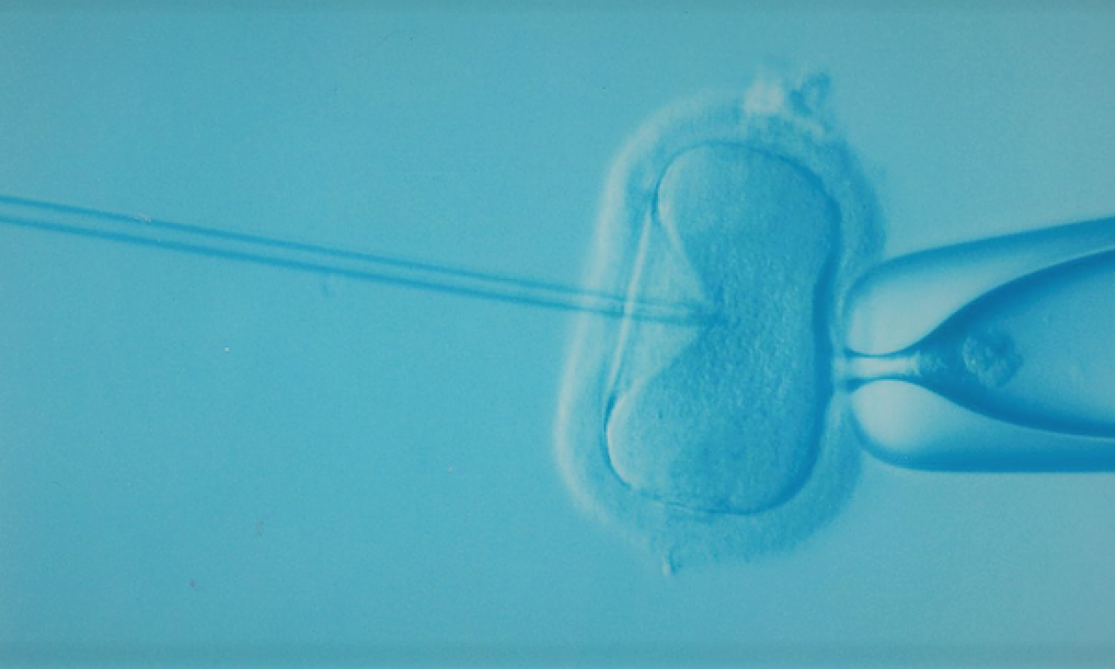 英語脳メルマガ 第号 A Record 1 In Babies Was Born Through In Vitro Fertilization Treatment の意味は 英語脳ネット